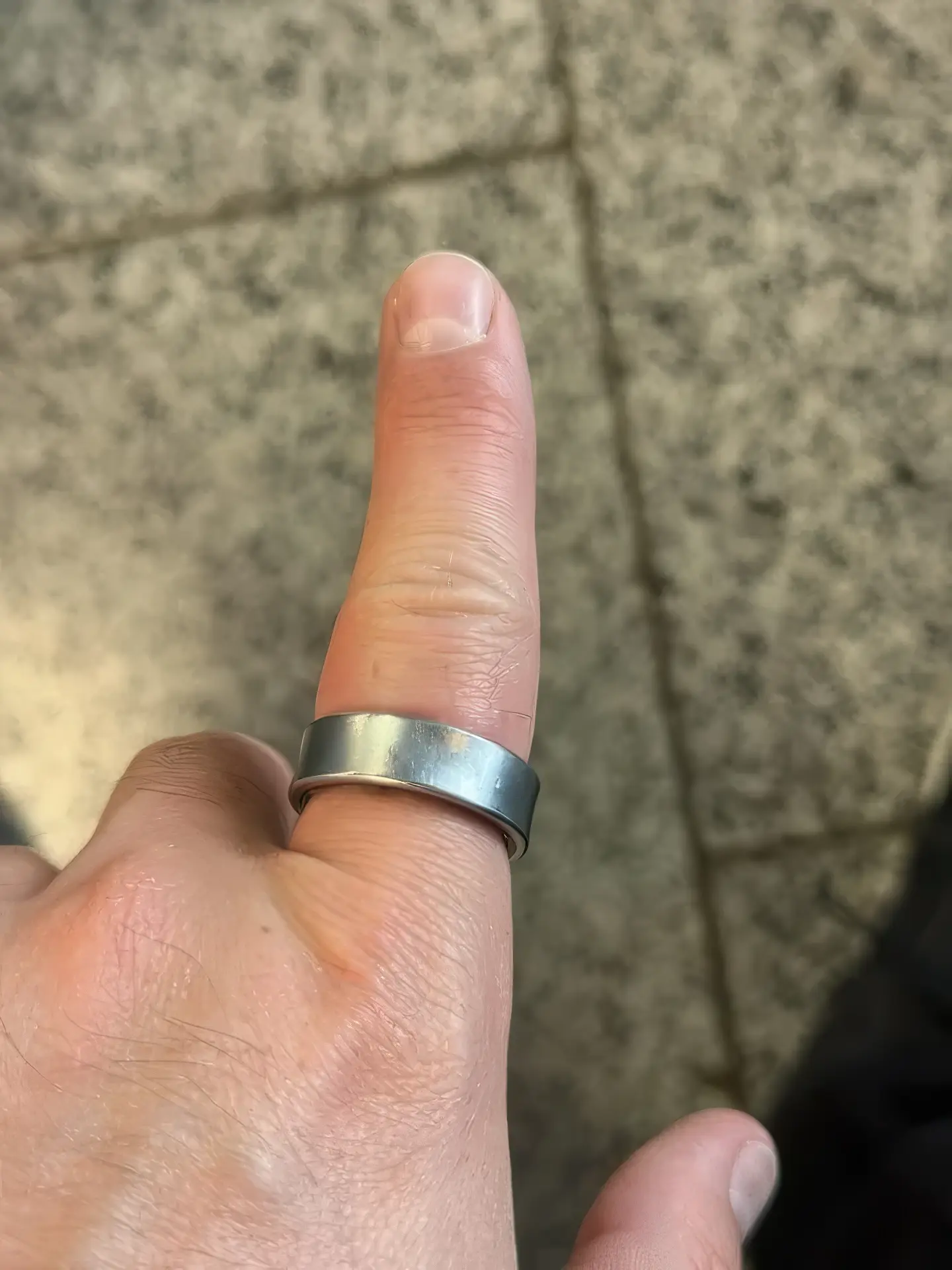 Кошмар наяву: аккумулятор Galaxy Ring вздулся и застрял на пальце владельца. Что делать и насколько это опасно?