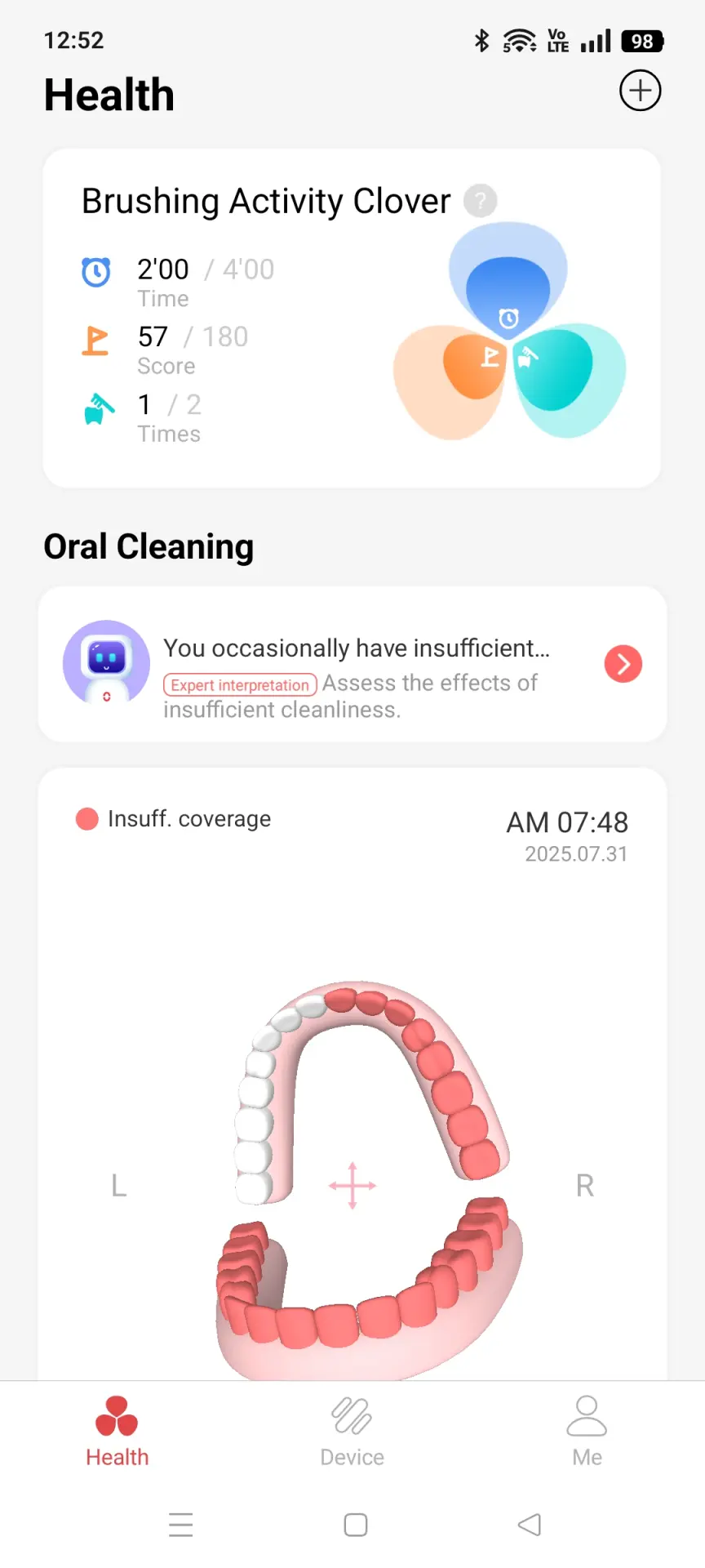 Обзор детской умной электрической зубной щётки Oclean X Kids Pro